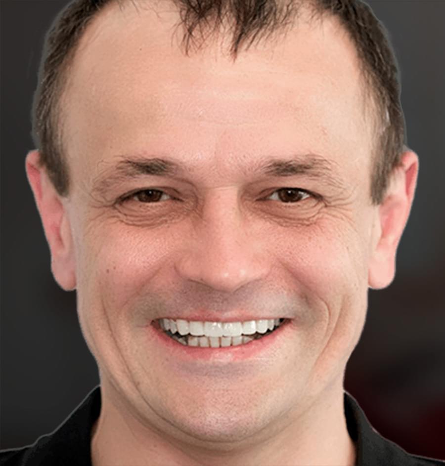 Вініри